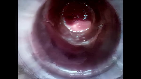 Schwarzes Loch oder rosa Loch?